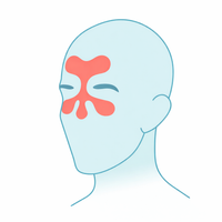 Sinus Pressure