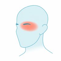 Cluster Headaches