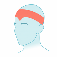Tension Headaches
